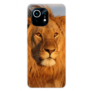 Funda de Gel Personalizada para Xiaomi